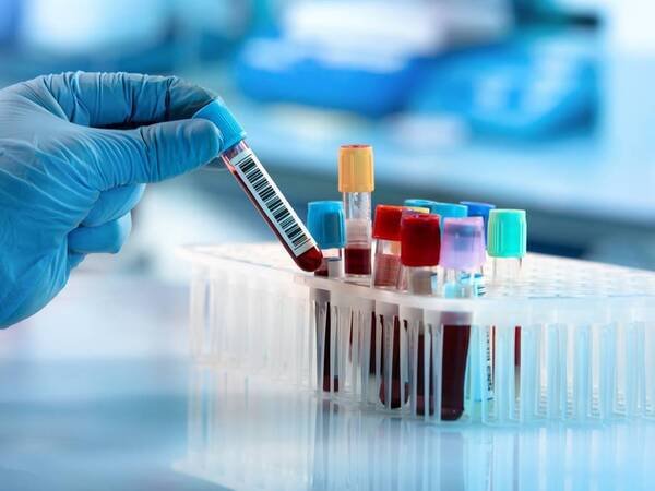 The Importance of Blood Tests by Dr Anil Batra A gloved hand holds a blood sample test tube, with several other blood vials in a rack, ready for testing in a laboratory setting.